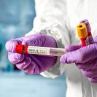 Коронавірус у Тернополі: за добу виявили 10 хворих