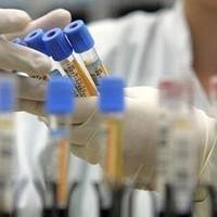 10 нових хворих на коронавірус виявили тернопільські епідеміологи за добу