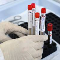 На Тернопільщині чергова атака COVID-19: Більше півсотні нових інфікованих