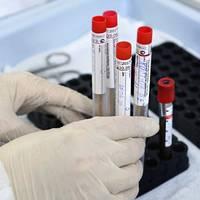 На Тернопільщині вже є кілька людей, які захворіли на COVID-19 повторно (фото)