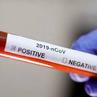 За добу на Тернопільщині виявили 51 хворого на коронавірус