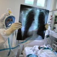 На Тернопільщині зараз рятують понад 50 важких хворих із COVID-19 (відео)