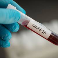 На Тернопільщині підтвердили 85 нових випадків коронавірусу