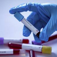 Нова жертва COVID-19 – на Монастирищині померла жінка, яка перебувала у важкому стані