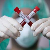 На Тернопільщині – двісті нових випадків коронавірусу. Четверо людей померли