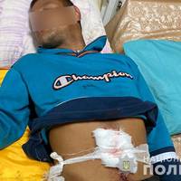 “Йшов 2 км стікаючи кров’ю”: на Тернопільщині під час сварки через їжу підрізали 20-річного хлопця (ФОТО)