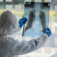 «Коронавірусний хет-трик»: на Тернопільщині знову 385 нових випадків інфікування