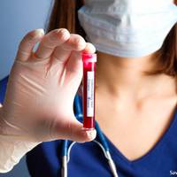 Український лікар розповів, чому коронавірус буває без температури