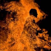 Житель Гусятинщини підпалив себе у центрі зайнятості – ушкоджена половина тіла