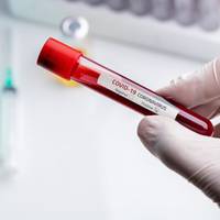 У Бережанах погодилися виконувати вимоги “червоної” зони