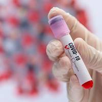 254 хворих на коронавірус виявили у Тернопільській області за добу