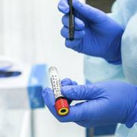 На Тернопільщині підтверджено 263 випадки зараження вірусом COVID-19