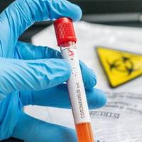 296 хворих на коронавірус виявили у Тернопільській області за добу