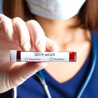 За минулу добу на Тернопільщині підтверджено 139 нових випадків COVID-19