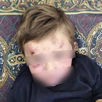 “Ледь не забив дитину”: на Тернопільщині чоловік кулаками виховував свого 4-річного пасинка (ФОТО)