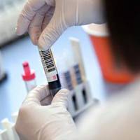 146 хворих на коронавірус виявили у Тернопільській області за добу