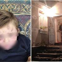 Хто захистить дитину: Вітчима, який до пів смерті побив 4-річного пасинка, відпустили під домашній арешт