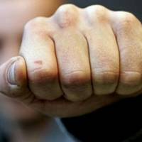 У Тернополі, біля бару «Бункермуз», 17-річного хлопця побили невідомі