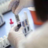 211 хворих на коронавірус виявили у Тернопільській області за добу