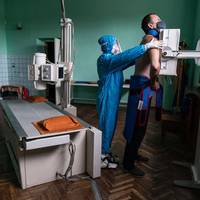 26052 випадків COVID-19 зафіксували на Тернопільщині