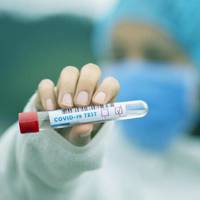 На Тернопільщині понад 370 нових випадків COVID-19