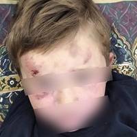 На Тернопільщині судитимуть тирана, який побив 4-річного пасинка, а потім підняв над головою і кинув з розмаху на землю