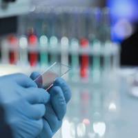 Коронавірус пішов на спад: на Тернопільщині за добу – менше 100 хворих