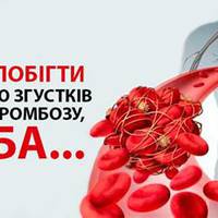 8 продуктів, щоб запобігти тромбозу та інсульту