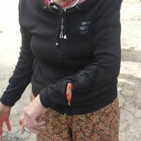 У Тернополі зграя бродячих собак покусала пенсіонерку
