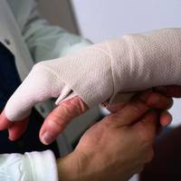 Обгоріло 50% тіла: як зараз живе тернопільський підліток, який торік отримав важкі травми (відео)