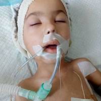Допоможіть врятувати дитину!!! Хлопчику, який впав у кому від ускладнень після кору, знову погіршало