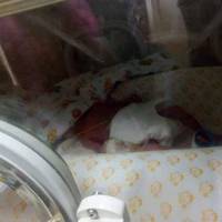 Соцмережі сколихнула новина про новонароджену дівчинку, яка важить всього 540 грамів