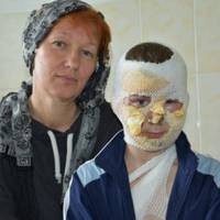 10-річний хлопчик, який ледь не згорів в пожежі під час похорону дідуся, розповів як врятувався