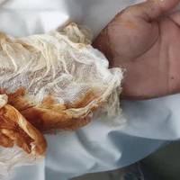 Чоловік з Тернопільщини впав в кислоту під час роботи на виробництві: потрібна термінова допомога