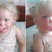 Уже відома дата проведення операції дворічній Надійці Славко