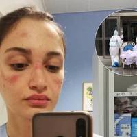 23-річна медсестра з Італії показала обличчя після багатогодинної роботи в масці і надихнула мережу