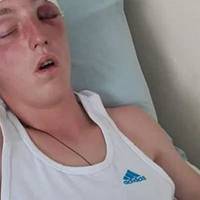 “Я помираю”, – подробиці побиття хлопців на Тернопільщині