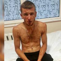 Переламані щелепа й ніс. На Тернопільщині побили хлопця до втрати свідомості (Фото)