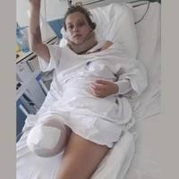 Трагедія через п’яну водійку: постраждала дівчина з Монастирищини