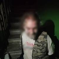Лежав на сходах з розбитою головою: у Тернополі п’яний дебошир відгамселив двох чоловіків