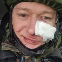 Лідера гурту Бумбокс поранено після мінеметроно обстрілу (ФОТО)