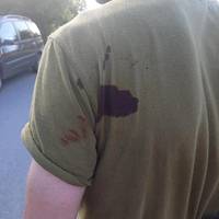 Чоловік напав з ножем на працівника ТЦК під час перевірки документів