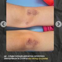 Жінка дві доби тримала неповнолітніх сестер на колінах без їжі. Їй оголосили підозру у катуванні — слідство